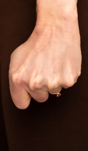 How to tell you are torn